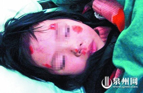 在急诊室里，受伤的孩子默默地流泪